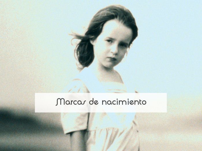 Marcas de nacimiento